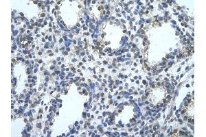 Rabbit Anti-BLZF1 Antibody       Paraffin Embedded Tissue:  Human alveolar cell   Cellular Data:  Epithelial cells of renal tubule  Antibody Concentration:   4.
