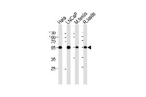Western blot analysis of lysates from Hela, LNCaP cell line, mouse testis and rat testis tissue lysates(from left to right), using ULK3 Antibody (C-term) (ABIN6243328 and ABIN6577077). (ULK3 Antikörper  (C-Term))