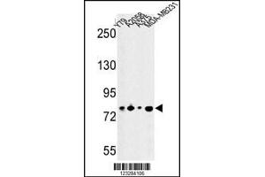 Western blot analysis of CSRP2BP Antibody in Y79, A2058, A375, MDA-MB231 cell line lysates (35ug/lane)