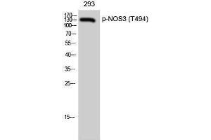 Western Blotting (WB) image for anti-Nitric Oxide Synthase 3 (Endothelial Cell) (NOS3) (pThr494) antibody (ABIN3182095) (ENOS Antikörper  (pThr494))