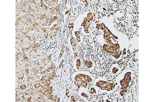 IHC analysis of DDR1 using anti-DDR1 antibody (ABIN7601407). (DDR1 Antikörper  (AA 341-909))