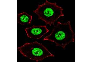 Fluorescent image of MCF-7 cells stained with ZN Antibody (Center) (ABIN1882027 and ABIN2843373).