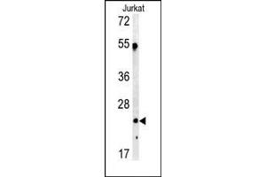 Western blot analysis of C1QA antibody (C-term) (ABIN391492 and ABIN2841459) in Jurkat cell line lysates (35 μg/lane). (C1QA Antikörper  (C-Term))