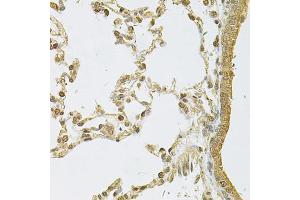 Immunohistochemistry of paraffin-embedded rat lung using PSMA5 Antibody (ABIN6292510) at dilution of 1:100 (40x lens). (PSMA5 Antikörper)