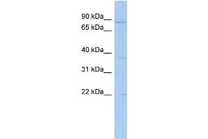 WB Suggested Anti-PCSK4 Antibody Titration: 0. (PCSK4 Antikörper  (N-Term))