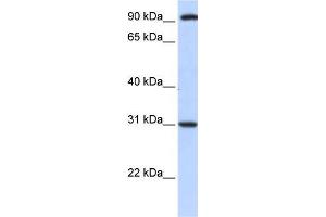 Human HeLa; WB Suggested Anti-ANKRA2 Antibody Titration: 0. (ANKRA2 Antikörper  (C-Term))