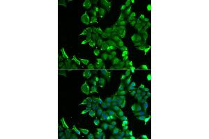 Immunofluorescence analysis of HeLa cell using STOM antibody. (Stomatin Antikörper)
