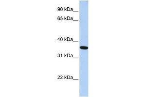 WB Suggested Anti-GTF2A1 Antibody Titration: 0. (GTF2A1 Antikörper  (N-Term))