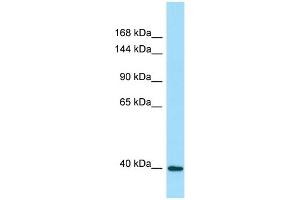 WB Suggested Anti-DRP2 Antibody Titration: 1. (DRP2 Antikörper  (Middle Region))