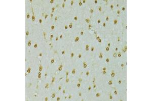 Immunohistochemistry of paraffin-embedded rat brain using RCC1 antibody (ABIN5973761) at dilution of 1/100 (40x lens). (RCC1 Antikörper)