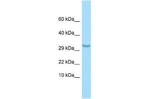 WB Suggested Anti-C1QTNF3 Antibody Titration: 1. (C1QTNF3 Antikörper  (N-Term))