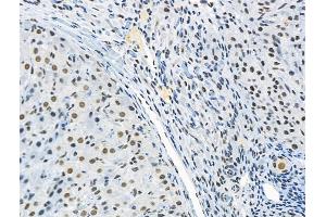 ABIN6256213 and ABIN6267090 at 1/100 staining Rat ovarian tissue by IHC-P.