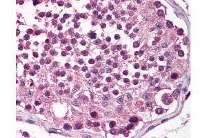 Anti-MADD antibody IHC of human testis.