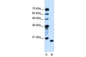 Image no. 1 for anti-Peptidyl-tRNA Hydrolase 2 (PTRH2) (AA 100-149) antibody (ABIN205058)