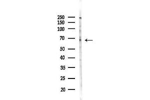 anti-Carboxylesterase 3 (CES3) (C-Term) antibody