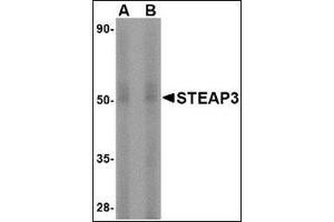 Western blot analysis of STEAP3 in rat liver tissue lysate with this product at (A) 1 and (B) 2 μg/ml. (STEAP3 Antikörper  (N-Term))