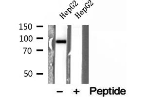 Western blot analysis of extracts of HepG2 cells, using ELAC2 antibody. (ELAC2 Antikörper  (N-Term))