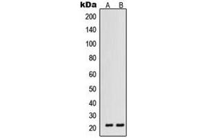 Western blot analysis of VEGFB expression in HT1080 (A), ACHN (B) whole cell lysates.