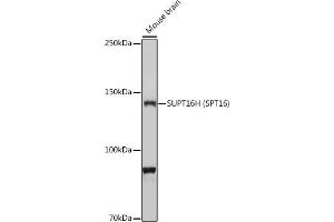 Western blot analysis of extracts of Mouse brain, using SUPT16H (SPT16) antibody (ABIN7267097) at 1:1000 dilution. (SUPT16H Antikörper)