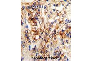 Immunohistochemistry (Paraffin-embedded Sections) (IHC (p)) image for anti-Cytochrome P450, Family 2, Subfamily J, Polypeptide 2 (CYP2J2) (N-Term) antibody (ABIN453601)