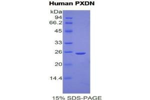 SDS-PAGE analysis of Human Peroxidasin Homolog Protein.