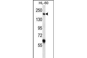 MYOM1 Antibody (Center) (ABIN657367 and ABIN2846414) western blot analysis in HL-60 cell line lysates (35 μg/lane). (Myomesin 1 Antikörper  (AA 904-933))