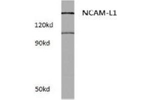 Western blot (WB) analysis of CD171 / L1CAM Antibody at 1/500 dilution in extracts from Raw264. (L1CAM Antikörper)