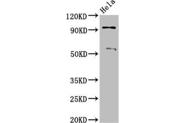 Adam23 Antikörper  (AA 498-647)
