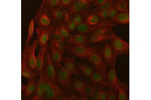 IF analysis of SAGE1 using anti-SAGE1 antibody (ABIN7602679) and anti-Beta Tubulin antibody (ABIN7602743). (SAGE1 Antikörper  (AA 94-633))