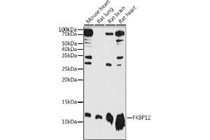 Western blot analysis of extracts of various cell lines, using FKBP12 antibody (ABIN3022503, ABIN3022504, ABIN3022505 and ABIN6218864) at 1:1000 dilution. (FKBP1A Antikörper  (AA 1-108))