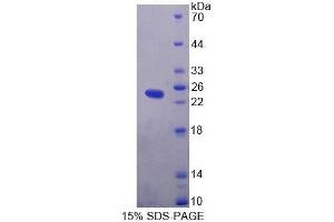 SDS-PAGE analysis of Human LYPLA2 Protein.