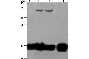 Western Blot analysis of A549 and K562 cell, Raji cell and Human fetal intestine tissue using IL17C Polyclonal Antibody at dilution of 1:250 (IL17C Antikörper)