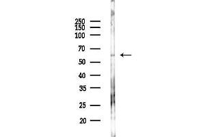 Western blot analysis of lysates from K562 cells(UV 30 min treatment), using Acetyl-FOXO3A (Lys271) Antibody at 1/1000 dilution.