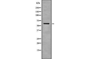 Western blot analysis of Cytochrome c Oxidase 1 using COLO205 whole cell lysates (COX1 Antikörper  (C-Term))