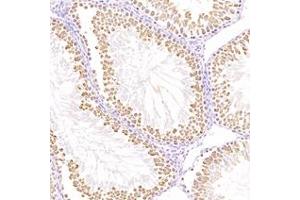Immunohistochemistry analysis of paraffin-embedded mouse testis using,TTC12 (ABIN7075869) at dilution of 1: 4400 (TTC12 Antikörper)