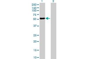 Western Blot analysis of DFNA5 expression in transfected 293T cell line ( H00001687-T02 ) by DFNA5 MaxPab polyclonal antibody. (DFNA5 Antikörper  (AA 1-496))