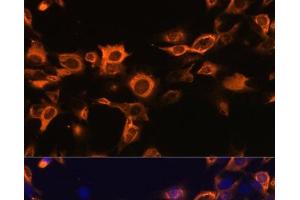 Immunofluorescence analysis of C6 cells using CSF2 Polyclonal Antibody at dilution of 1:100. (GM-CSF Antikörper)