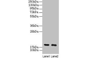 Western blot All lanes: UBE2I antibody at 2 μg/mL Lane 1: 293T whole cell lysate Lane 2: EC109 whole cell lysate Secondary Goat polyclonal to rabbit IgG at 1/15000 dilution Predicted band size: 19 kDa Observed band size: 19 kDa (UBE2I Antikörper  (AA 1-157))