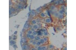 IHC-P analysis of Human Tissue, with DAB staining. (Dystrophin Antikörper  (AA 3048-3328))