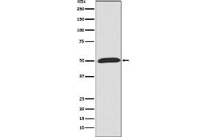 Western blot analysis of Wnt5a expression in HeLa cell lysate.
