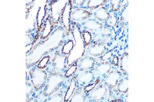 Immunohistochemistry (IHC) image for anti-Cadherin 1, Type 1, E-Cadherin (Epithelial) (CDH1) (AA 700-800) antibody (ABIN6138279)
