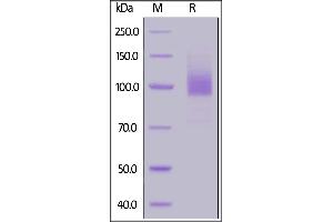 SDS-PAGE (SDS) image for Epidermal Growth Factor Receptor (EGFR) (AA 25-645) (Active) protein (His tag,AVI tag,Biotin) (ABIN5674594)