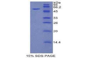 SDS-PAGE (SDS) image for Hepatocyte Growth Factor Activator (HGFA) (AA 104-351) protein (His tag,GST tag) (ABIN2122959) (HGFA Protein (AA 104-351) (His tag,GST tag))