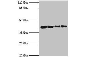 Western blot All lanes: SEPHS1 antibody at 3. (SEPHS1 Antikörper  (AA 1-392))
