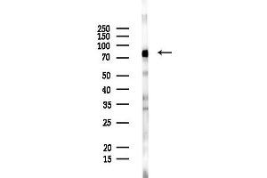 anti-Adenosine Deaminase, RNA-Specific, B1 (ADARB1) (Internal Region) antibody