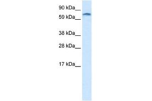 Human heart; WB Suggested Anti-ZNF84 Antibody Titration: 1.