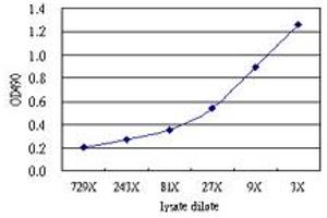 IL1A (Human) Matched Antibody Pair