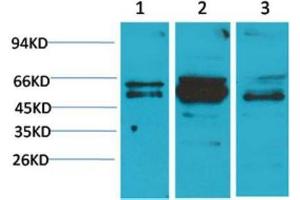 Western Blot (WB) analysis of 1) A431, 2)Mouse Brain Tissue, 3) Rat Brain Tissue with Flotllin-2 Rabbit Polyclonal Antibody diluted at 1:2000. (Flotillin 2 Antikörper)