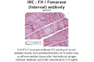 Image no. 2 for anti-Fumarate Hydratase (FH) (Internal Region) antibody (ABIN1734346) (FH Antikörper  (Internal Region))