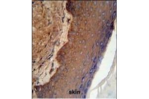 KRT9 Antibody (Center ) (ABIN652316 and ABIN2841447) IHC analysis in formalin fixed and paraffin embedded skin tissue followed by peroxidase conjugation of the secondary antibody and DAB staining. (KRT9 Antikörper  (AA 302-331))